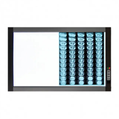 Негатоскопы медицинские: купить, цена в Киеве (Украина) | Maestro